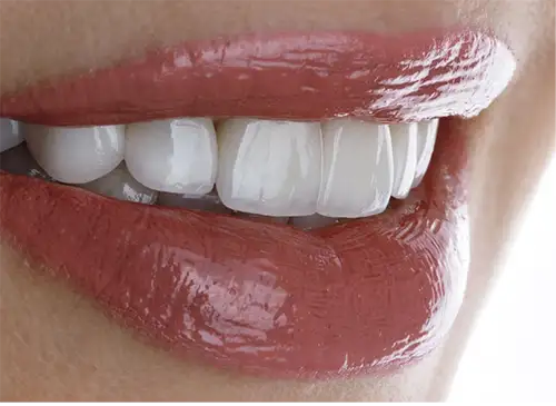 COSMETIC DENTISTRY